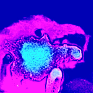 zogat
