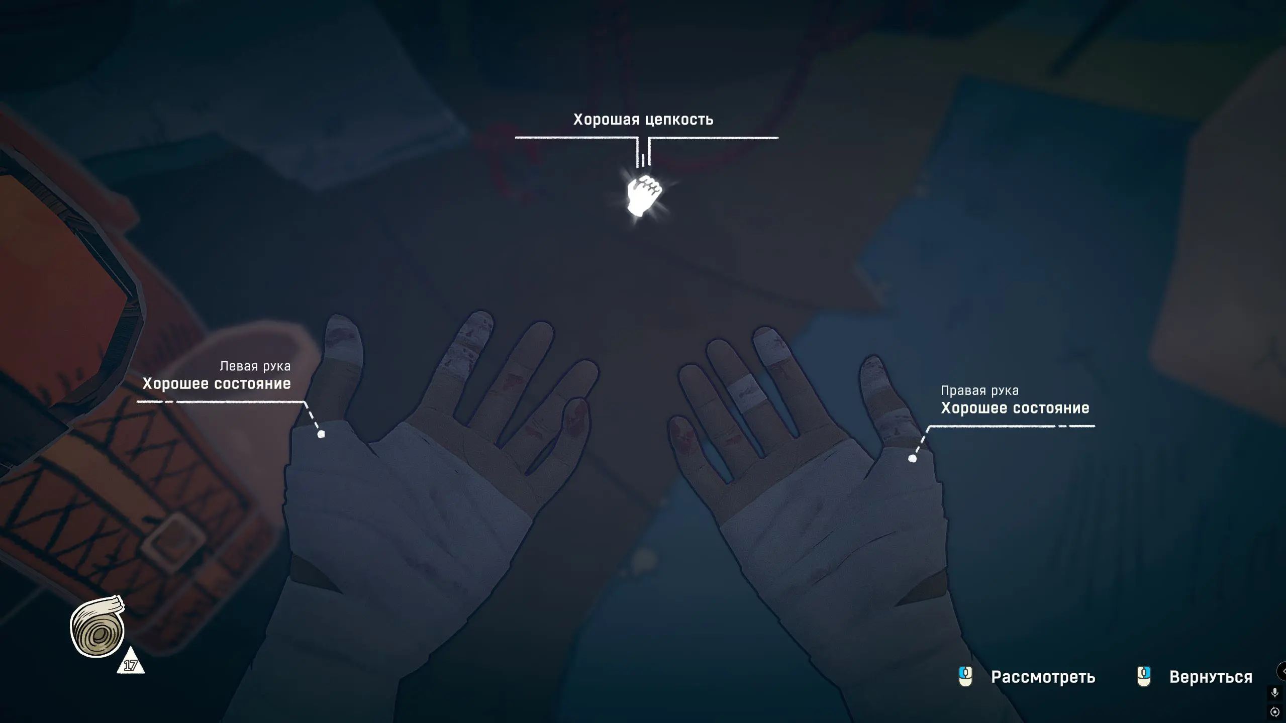 Повреждения наглядны и очевидны. Мы будем палец за пальцем перебинтовывать свои руки - самый наш надёжный и верный инструмент в горах.